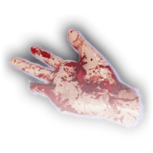 Gale's Severed Hand image